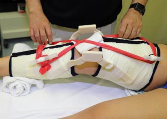 A doctor custom fitting a brace